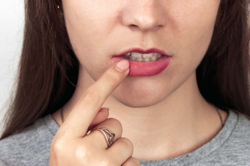 Woman pointing to her teeth